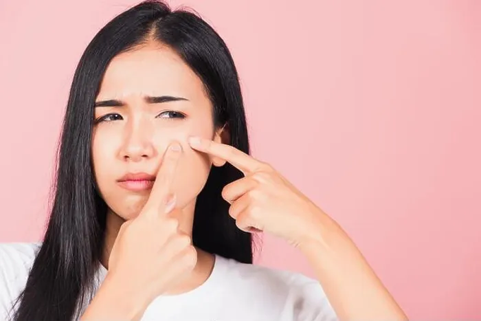 Framed Print : Portrait teenage Asian beautiful young woman having skin problems squeezing pimples on her face Framed Print : Portrait teenage Asian beautiful young woman having skin problems squeezing pimples on her face