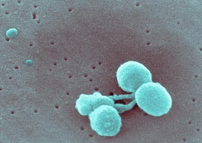 Framed Print : Scanning electron micrograph Streptococcus pneumoniae Framed Print : Scanning electron micrograph Streptococcus pneumoniae