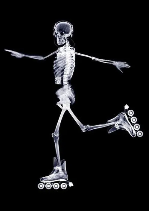Framed Print : Skeleton in-line skating, X-ray Framed Print : Skeleton in-line skating, X-ray