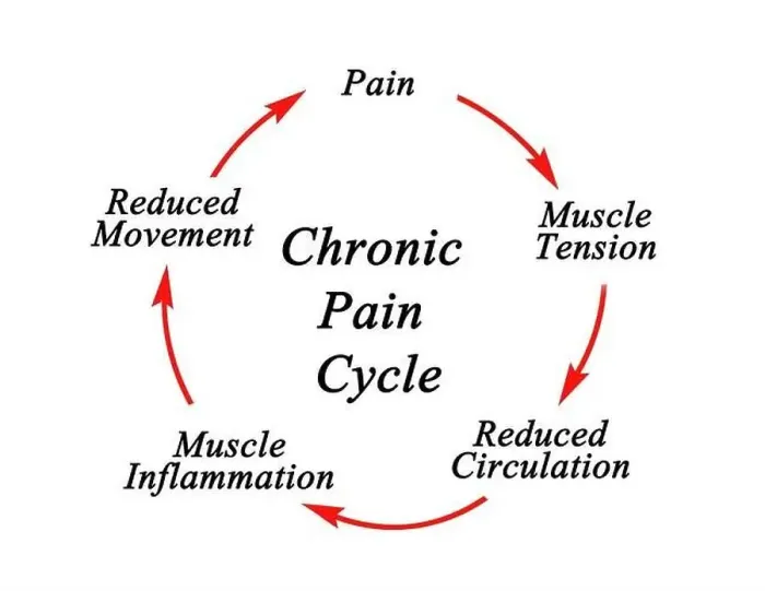 Framed Print : Steps in Chronic Pain Cycle Framed Print : Steps in Chronic Pain Cycle