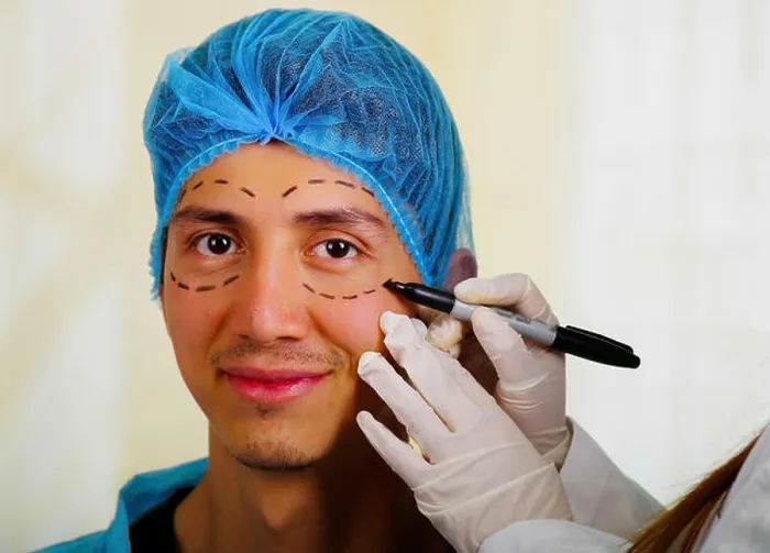 Framed Print : Surgeon drawing marks on male face. Plastic surgery concept Framed Print : Surgeon drawing marks on male face. Plastic surgery concept