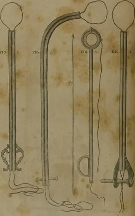 Framed Print : A system of surgery (Volume 4). PLATE XXXI TIG-. plate xxxn Framed Print : A system of surgery (Volume 4). PLATE XXXI TIG-. plate xxxn