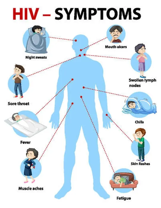 Framed Print : Symptoms of HIV infection infographic Framed Print : Symptoms of HIV infection infographic