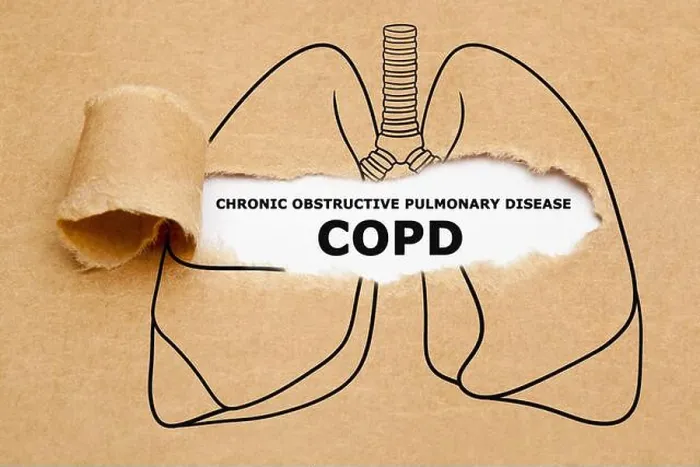 Framed Print : Text Chronic Obstructive Pulmonary Disease COPD appearing behind torn brown paper in human lungs drawing Framed Print : Text Chronic Obstructive Pulmonary Disease COPD appearing behind torn brown paper in human lungs drawing