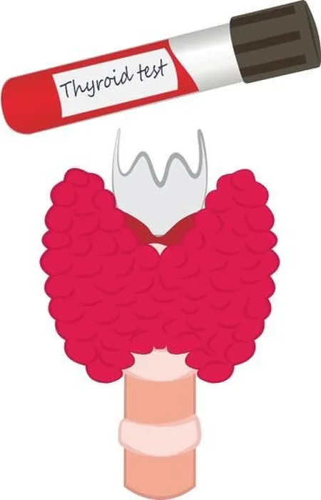 Framed Print : Thyroid test tube vector illustration diagnosis technology Framed Print : Thyroid test tube vector illustration diagnosis technology