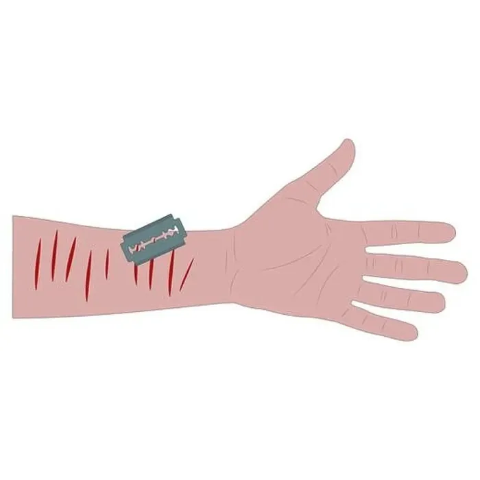 Framed Print : white man's hand with bleeding cuts and a blade. suicide attempt. white background isolated stock vector illustration Framed Print : white man's hand with bleeding cuts and a blade. suicide attempt. white background isolated stock vector illustration