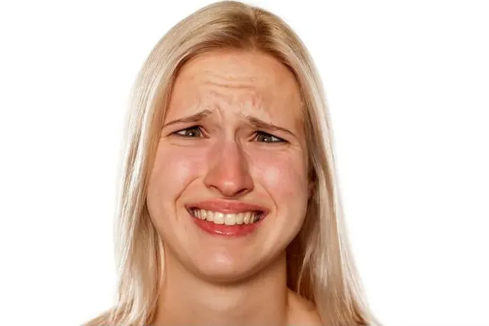 Framed Print : Young blonde with pimples on her forehead making a funny faces Framed Print : Young blonde with pimples on her forehead making a funny faces