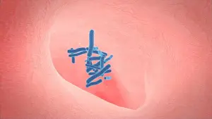 Breathing Prints: 3d illustration of human lung structure.pneumonia.tuberculosis