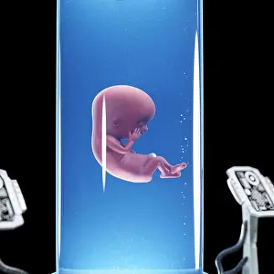 Gynecology Prints: 3d rendered medically accurate illustration of a fetus in a tank