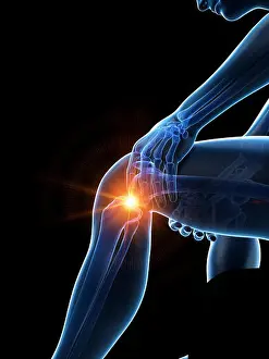 Knee Prints: 3d rendered medically accurate illustration of a man having a painful knee