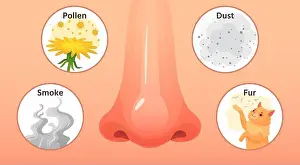 Fever Prints: Allergic sickness. Red nose, allergy illnesses symptoms and allergens