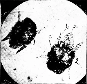 Immune Prints: Animal parasites and parasitic diseases