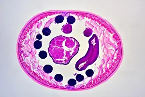 Cross Section Prints: Ascaris lumbricoides male showing cuticle