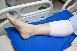 Hurt Prints: Bandaged leg on a hospital bed
