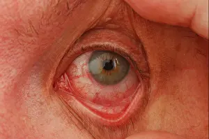 Exhausted Prints: My bloodshot eyes after leaving contact lenses in for to long dsca 3274