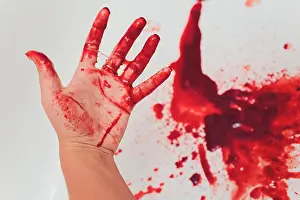 Stretch Prints: bloody wounds on hand bleeds on a white background