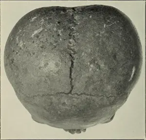 Bookyear1901 Prints: Bulletin. Ethnology. a. An asymmetrical skull
