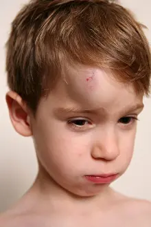 CHILD WITH HEMATOMA