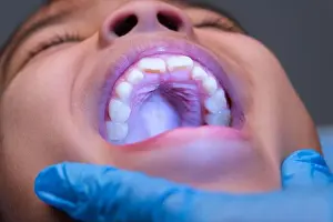 Dentistry Prints: Close-up inside the oral cavity of a healthy child with beautiful rows of baby teeth