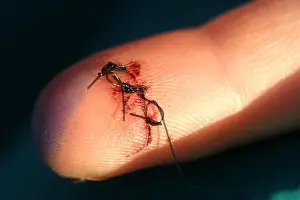 Wound Prints: Closeup of a finger with three sutures
