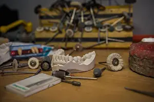 Dentist Prints: a copy of a human tooth cast in plaster stands on the table of a dentist