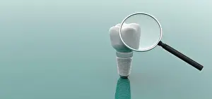 Dentistry Prints: Dental implant and magnifying glass isolated on green background. 3d illustration