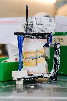 Dentistry Prints: Dental mold of teeth in articulator covered in plaster at a dental lab