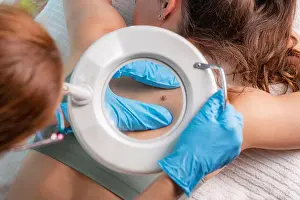 Check Up Prints: Dermatologist checking mole