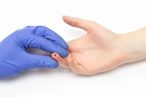 Inflammation Prints: A doctor makes a general blood test to a female patient for a study of red blood cell and hemoglobin values