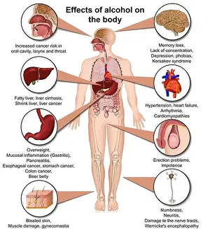 Hepatitis Prints: Effects of alcohol on the body 3d medical vector illustration isolated on white background eps 10 infographic