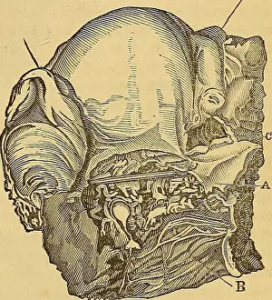 Booksubjectanatomy Prints: Elements of pathological anatomy