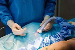 Laser Prints: Endovenous laser coagulation for treatment varicose veins and ultrasound machine