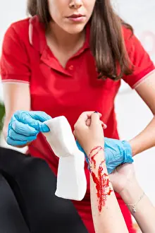 Teach Prints: First aid training. Burn injury. First aid course
