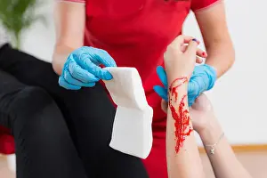 Teach Prints: First aid training. Burn injury. First aid course