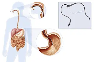 Examine Prints: GASTROSCOPY, ILUSTRATION