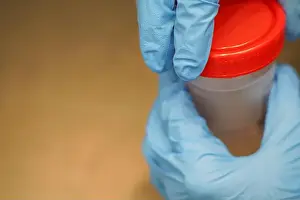 Stool Prints: hands in nurse gloves collect a tube of stool for analysis in the laboratory