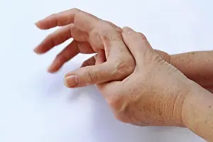 Hurt Prints: The hands of a woman with Parkinson's disease tremble very strongly