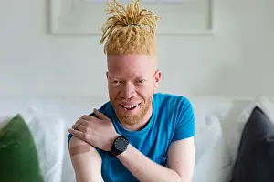 Corona Virus Prints: Happy african american albino man with plaster after vaccination