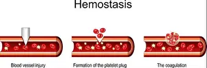 Bleeding Prints: Hemostasis. Cross section of a Blood Vessel after injury