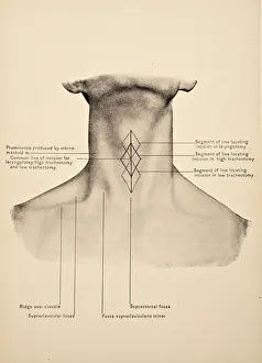 Mandible Prints: Illustration of the Human Neck copyright 1904