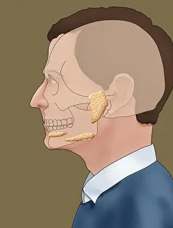 Illustration showing the location of the salivary glands in a male profile