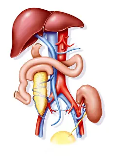 Transplanting Prints: KIDNEY-PANCREAS TRANSPLANT, ILL