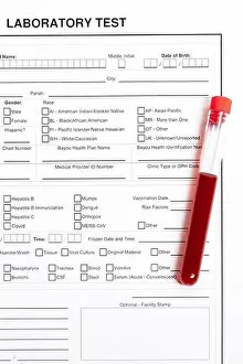 Results Prints: Laboratory form to fill in with results of blood test and red tube with blood