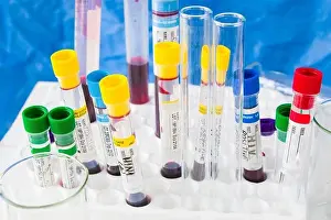 Laboratory table, blood test tube samples and glassware with liquid chemical elements