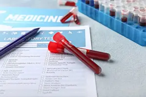 Tubes Prints: Laboratory test form and blood samples on table