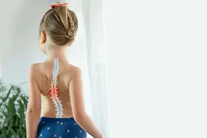 Elbow Prints: back little girl with scoliosis