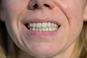 Dental Prints: A macro shot of a person's smile