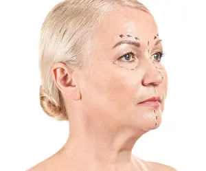 Medic Prints: Mature woman with marks on her face against white background. Concept of plastic surgery