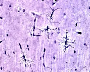 Microglia cells stained with Rio Hortega's silver carbonate method in the grey matter of the brain. This type is the ramified or resting microglia