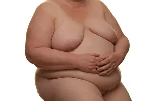 Obese Prints: Naked obese woman sitting